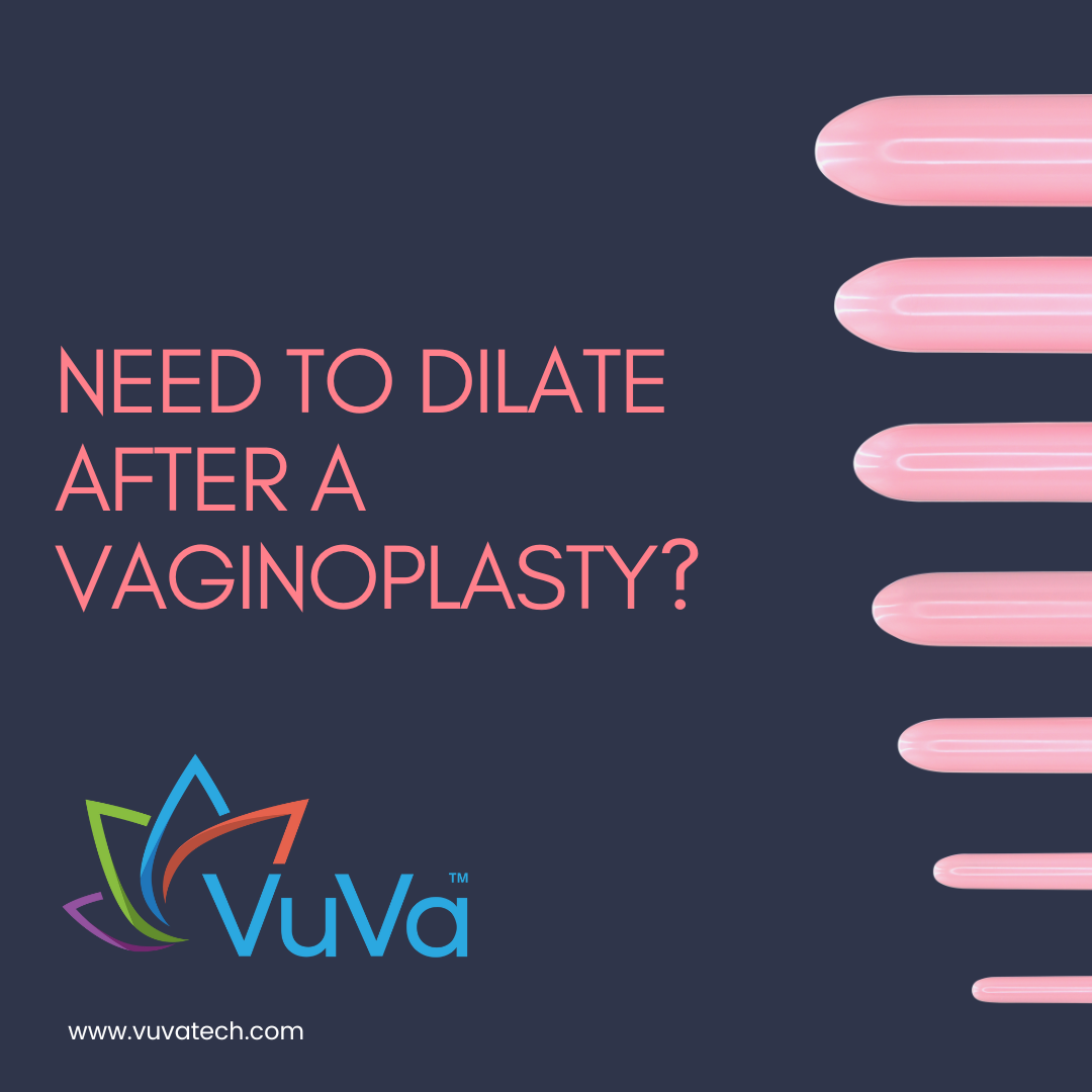 Do Trans Women Have to Dilate Forever? A Realistic, Trauma-Informed Guide to Life After Vaginoplasty Vuvatech Do Trans Women Have to Dilate Forever? A Realistic, Trauma-Informed Guide to Life After Vaginoplasty Vuvatech