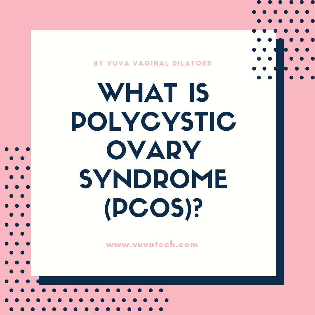 What is Polycystic Ovary Syndrome (PCOS)?