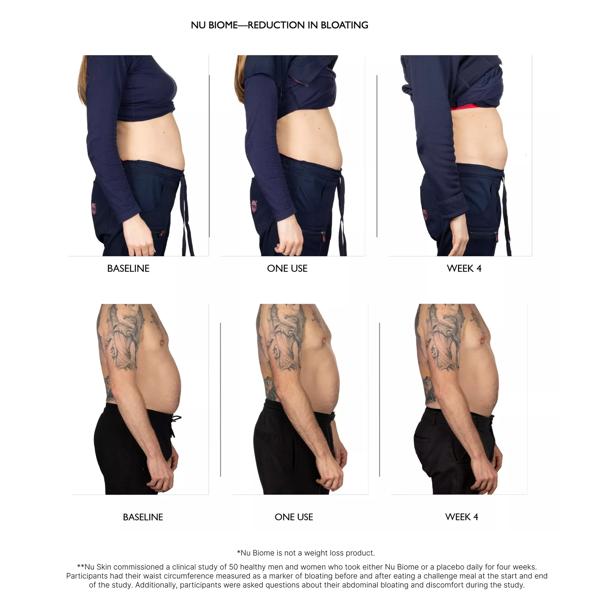 Before and after comparison of bloating reduction using a product labeled 'NU BIOME'.