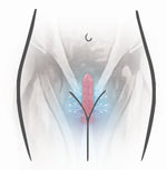 Size 1 & 2 Neodymium Magnetic Vaginal Combo Set  Vuvatech   
